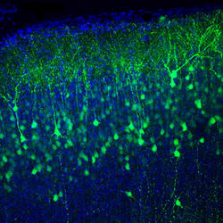 Fabriquer du cortex cérébral humain semble désormais possible