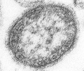 Pourquoi le virus de la rougeole est-il si contagieux ?