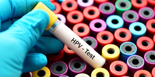 Le test HPV recommandé chez les femmes de plus de 30 ans