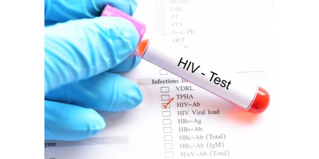 Baisse du nombre de découvertes de séropositivité au VIH entre 2017 et 2018 Baisse du nombre de découvertes de séropositivité au VIH entre 2017 et 2018