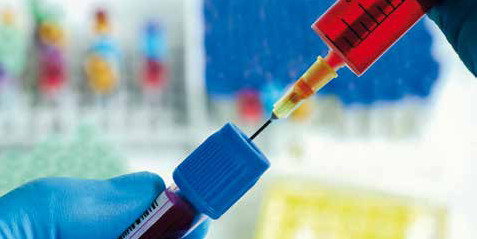 Baisse de cotation pour 77 actes de biologie médicale Baisse de cotation pour 77 actes de biologie médicale