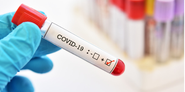Evaluer la fiabilité des tests sérologiques Evaluer la fiabilité des tests sérologiques