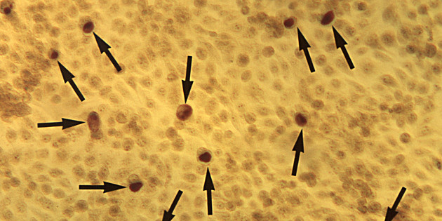 Moins d’une demi-heure pour détecter une infection à Chlamydia trachomatis