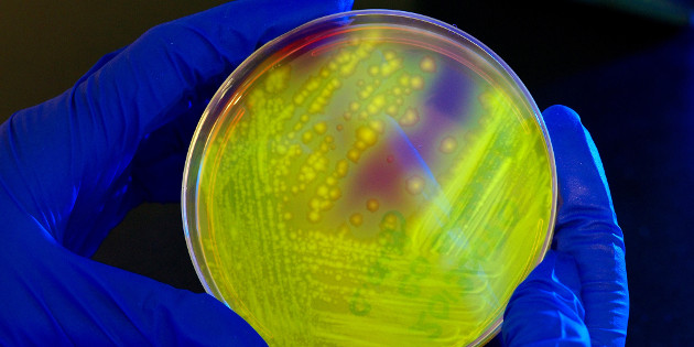 Traitement par transfert de microbiote fécal des infections récidivantes à Clostridium difficile