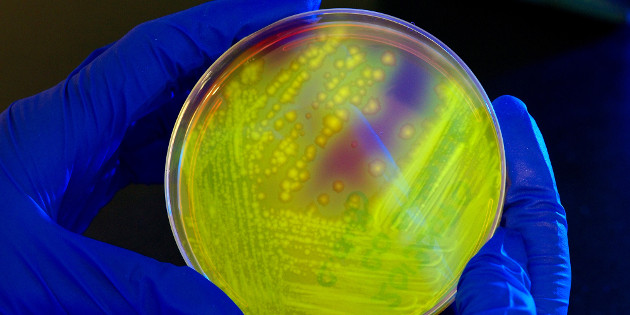 Traitement par transfert de microbiote fécal des infections récidivantes à Clostridium difficile Traitement par transfert de microbiote fécal des infections récidivantes à Clostridium difficile