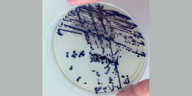 Modification de la Nomenclature des actes de biologie médicale pour les actes de diagnostic biologique des infections à Clostridium difficile