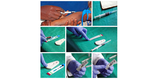 Dépistage de l’infection par le VIH dans les laboratoires entre 2003 et 2014