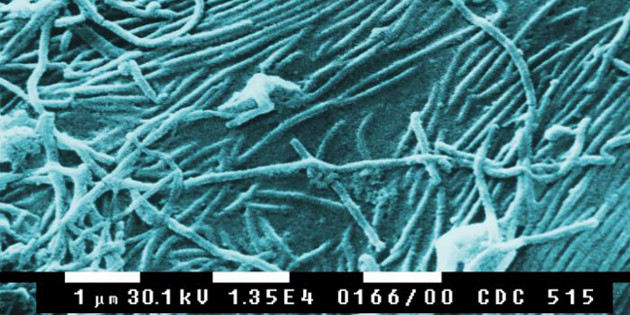 Crédit photo : © PLoS Biol 3/11/2005: e403