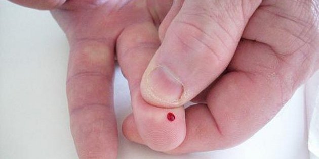 Un nouveau marqueur prédictif des risques de diabète Un nouveau marqueur prédictif des risques de diabète