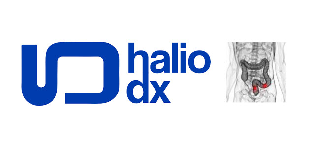 HalioDx annonce une collaboration clinique pour évaluer Immunoscore dans le cancer du côlon