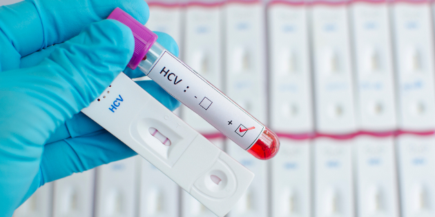 Un test de dépistage de l’hépatite B ou C offert en Suisse