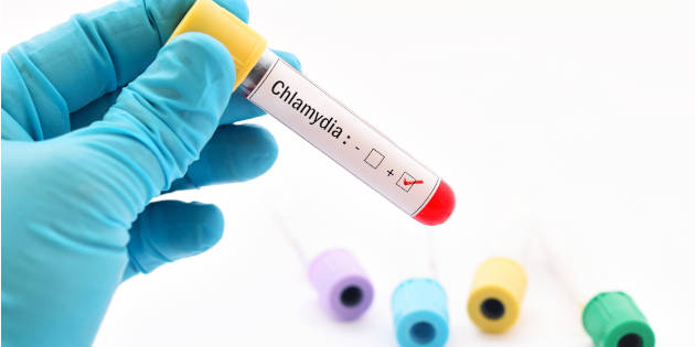 Dépistage systématique de l’infection à Chlamydia trachomatis