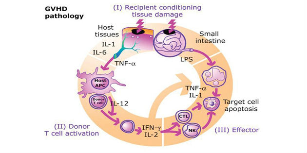 Un nouveau biomarqueur pour détecter les patients greffés susceptibles d’avoir la maladie du greffon contre l’hôte