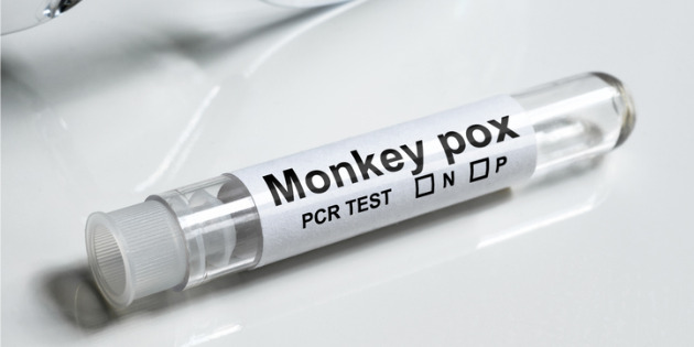 Détection du virus Monkeypox