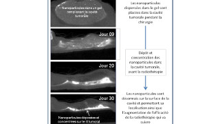 NBTX-TOPO, le premier produit thérapeutique nano avec un radar embarqué