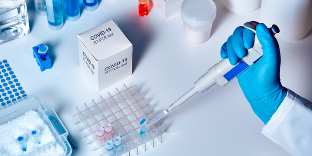 Tests validés pour le diagnostic de SARS-CoV-2 Tests validés pour le diagnostic de SARS-CoV-2