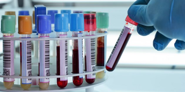 L’arrêté fixant les catégories de professionnels autorisées à réaliser des prélèvements et des examens de biologie médicale est paru au Journal officiel L’arrêté fixant les catégories de professionnels autorisées à réaliser des prélèvements et des examens de biologie médicale est paru au Journal officiel