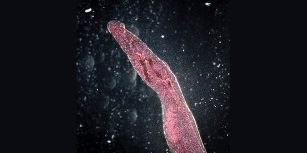 Actualisation des actes de biologie médicale relatifs au diagnostic de la bilharziose Actualisation des actes de biologie médicale relatifs au diagnostic de la bilharziose