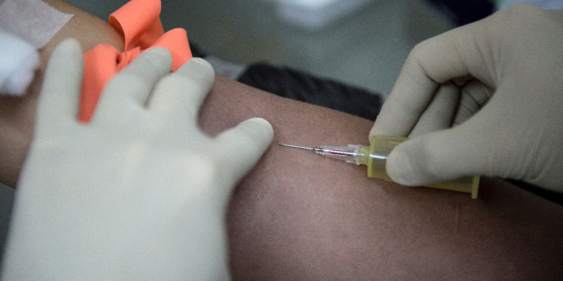 Un nouveau test sanguin pour détecter tôt un cancer du pancréas