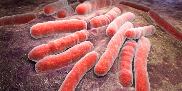 Infection tuberculeuse latente : un nouveau test de détection concurrent de l’interféron gamma