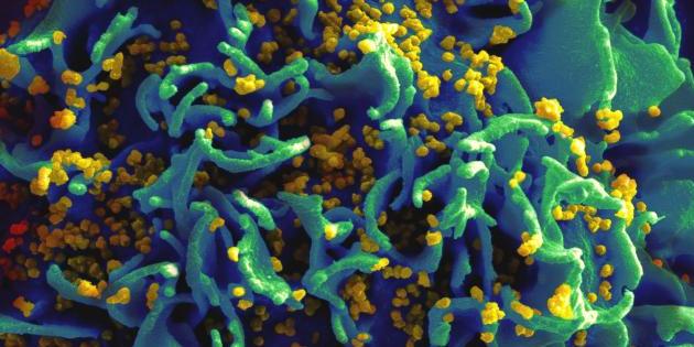 De nouvelles recommandations pour la prise en charge des personnes infectées par le VIH