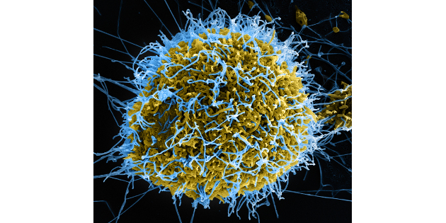 L’Institut Pasteur souhaite renforcer sa recherche sur le virus Ebola