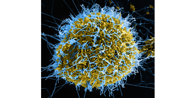 L’Institut Pasteur souhaite renforcer sa recherche sur le virus Ebola L’Institut Pasteur souhaite renforcer sa recherche sur le virus Ebola