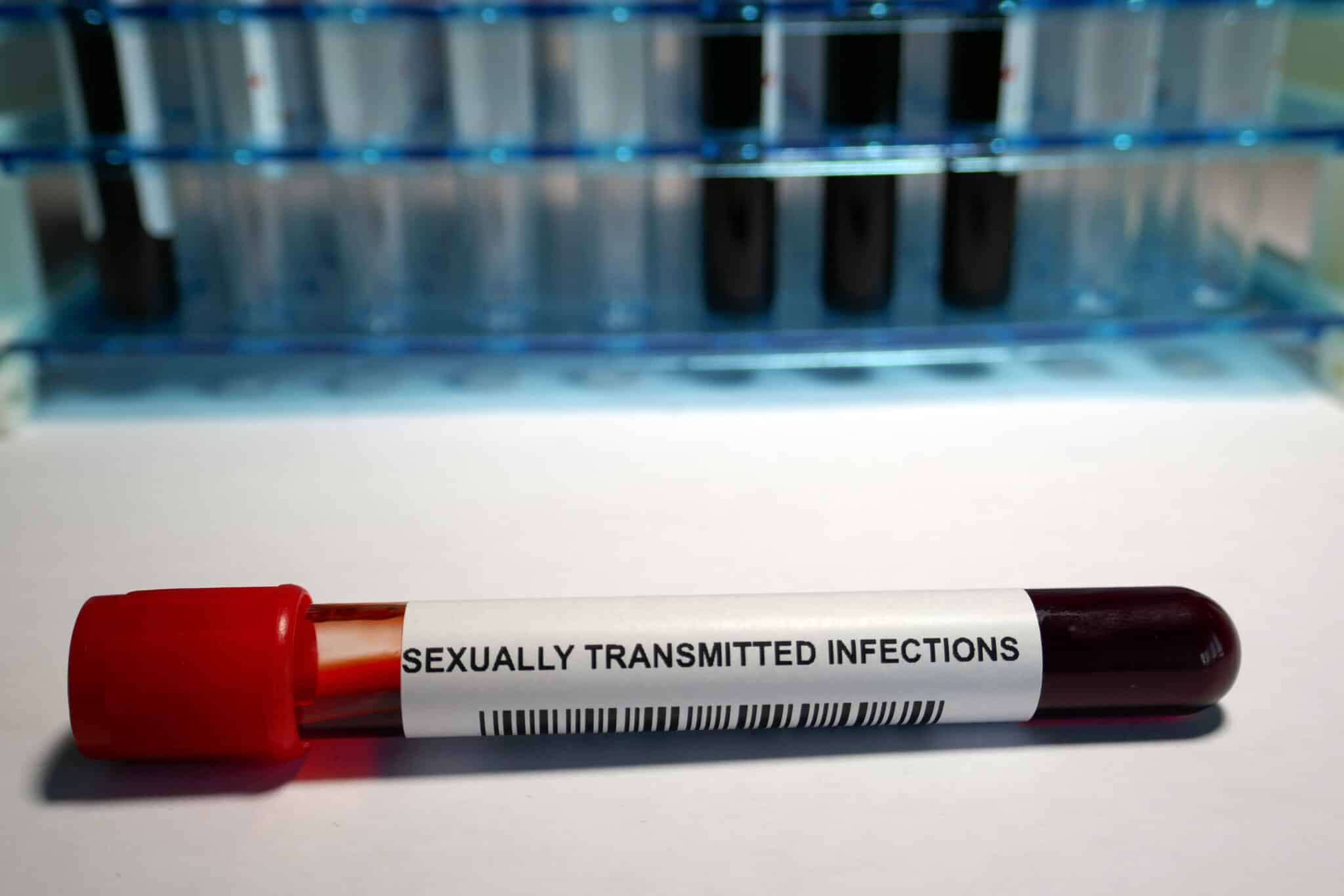 VIH puis IST sans ordo, vers un nouveau modèle de prévention