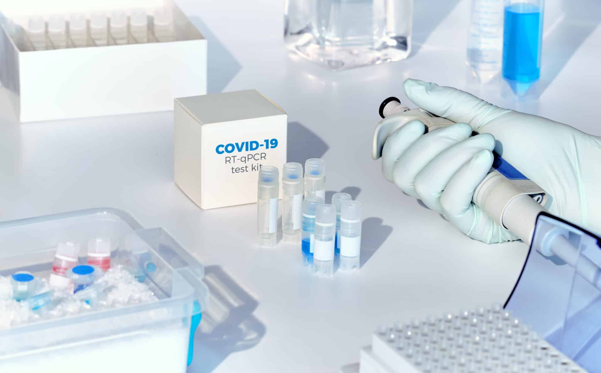 Quelle interprétation des valeurs de Ct de la PCR Covid-19 ? 