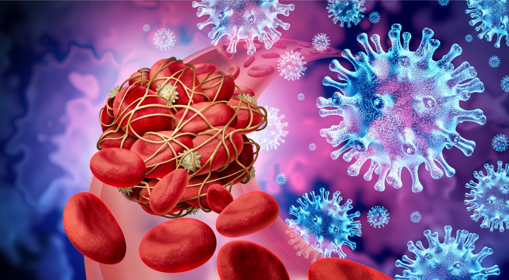 Covid-19 et risque de thrombose, quel bilan biologique ?