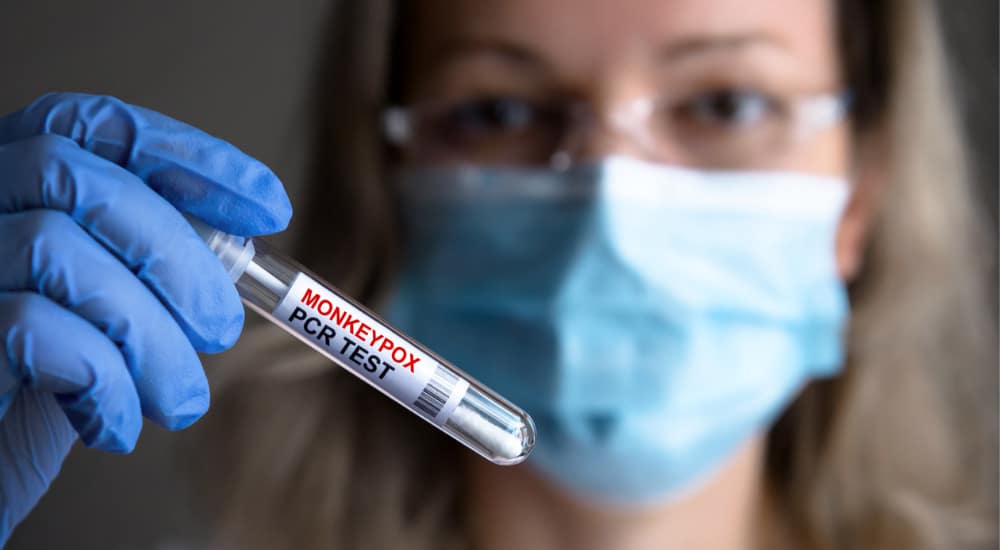 Confirmation virologique recommandée pour le virus mpox