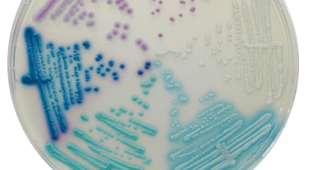 boîte de pétri et colonies de champignons colorées par le réactif CHROMagar Candida plus