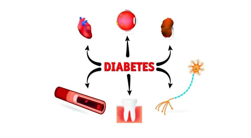« Le diabète devient un problème de type épidémique »