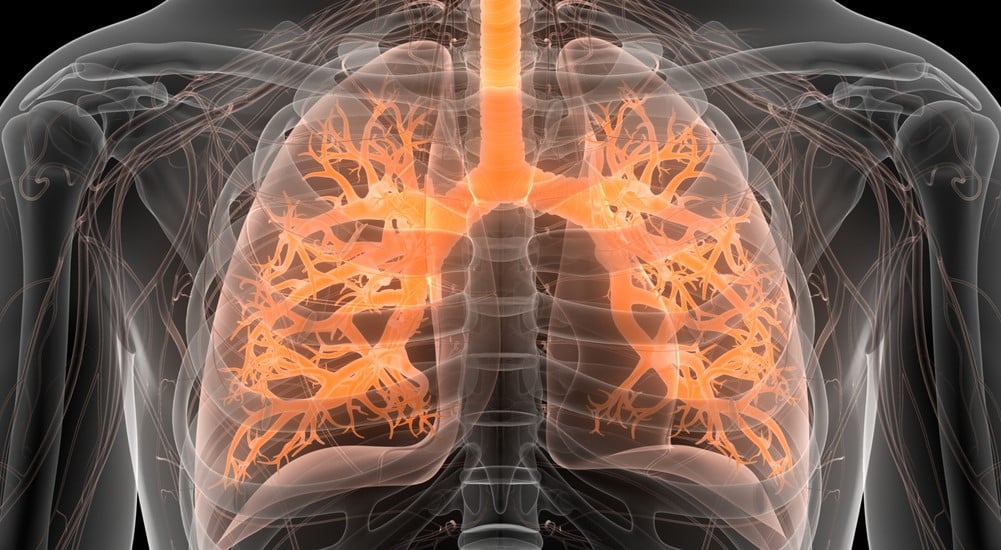 image de type radiographique mettant en avant les poumons