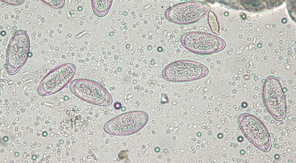 parasitologie,PCR multiplexe,Helminthes