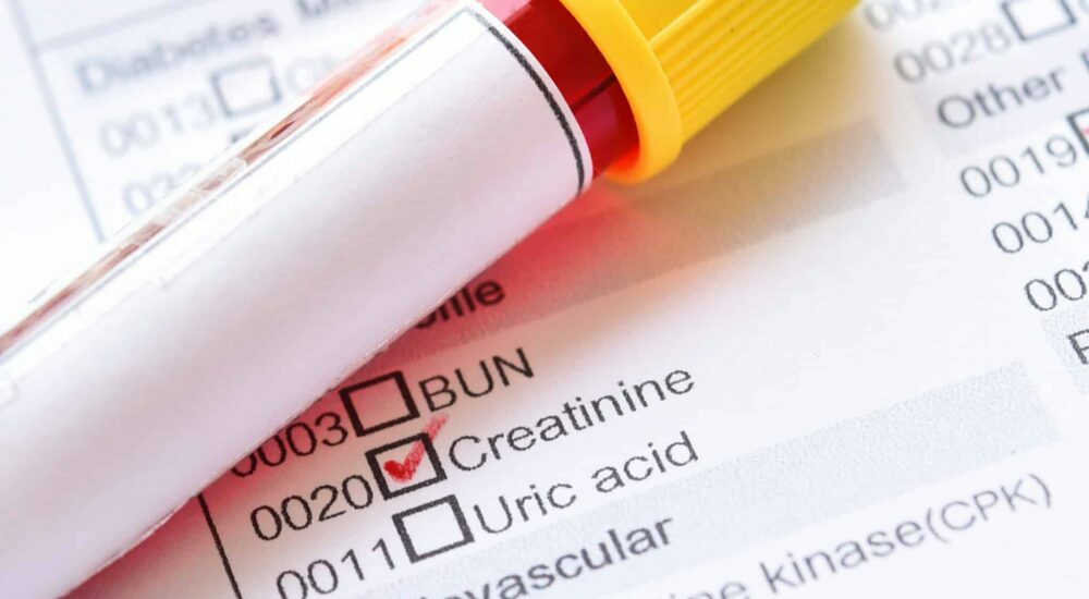 échantillon de sang avec un formulaire pour doser la créatinine