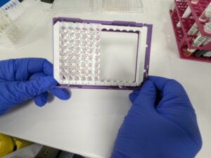 immunohématologie,incompatibilité foetomaternelle,allo-immunisation,anticorps antiérythrocytaire