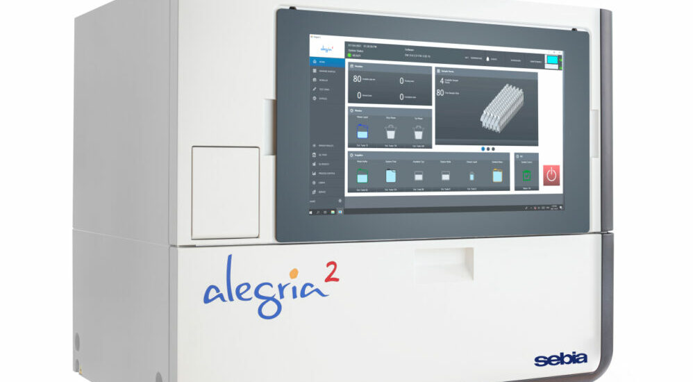 Sebia,auto-immunité,myélome multiple