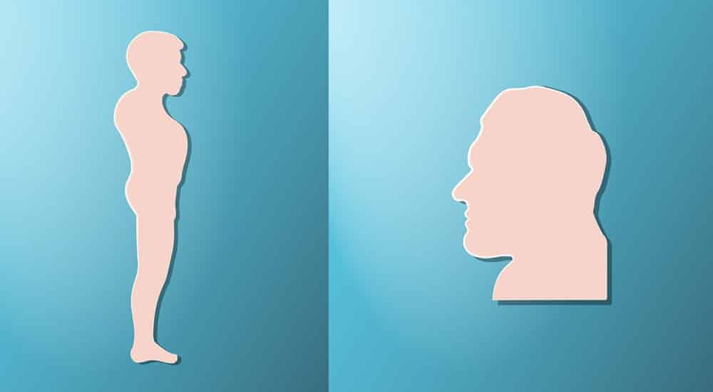 schéma illustrant les déformations du corps subi pendant l'acromégalie